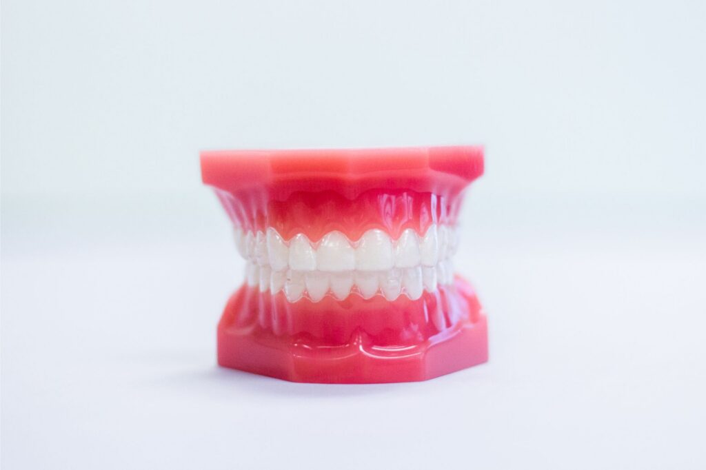 Invisalign clear aligners available at Moon Signature Dentistry in Olathe, Kansas